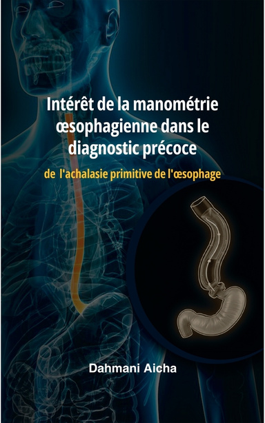 Intérêt de la manométrie œsophagienne dans le diagnostic précoce de l’achalasie